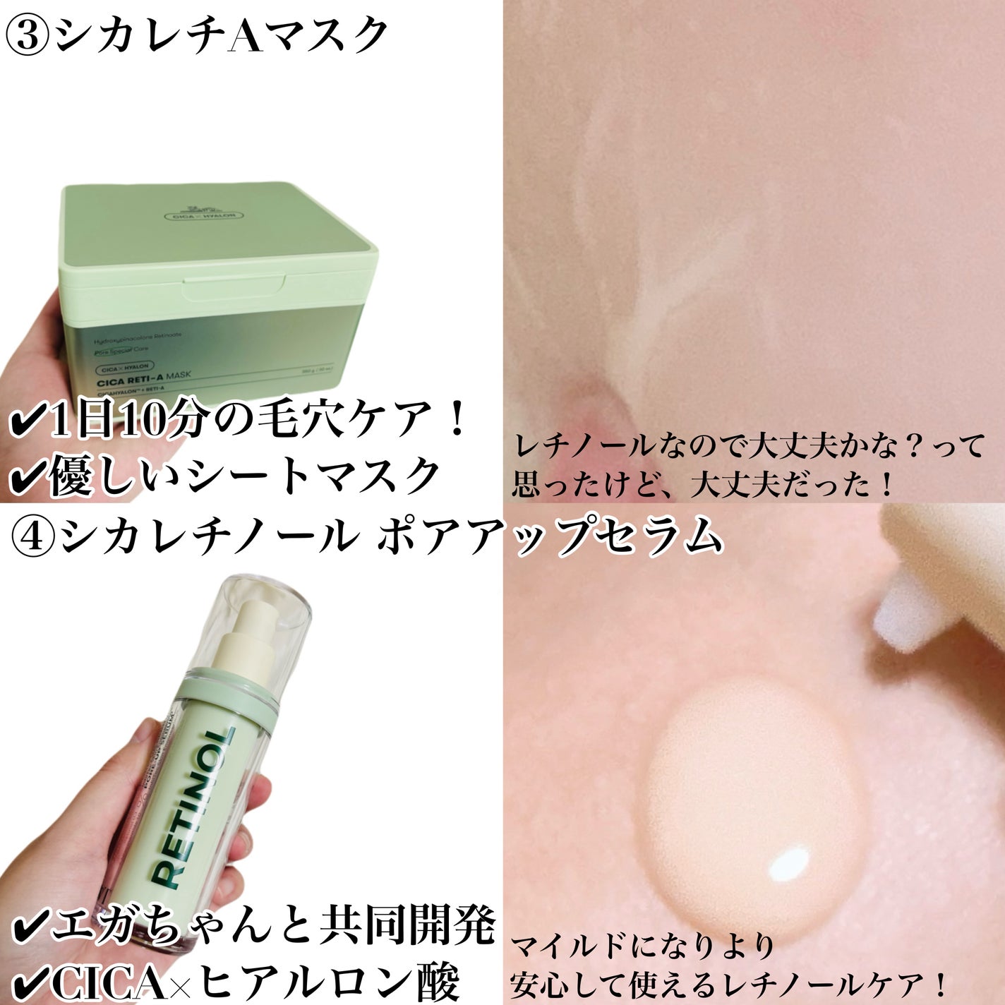 シカレチA クリーム0.05/VT/フェイスクリームを使ったクチコミ(4枚目)