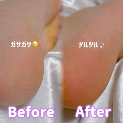 フットケアセット/BAREN/その他キットセットを使ったクチコミ(3枚目)