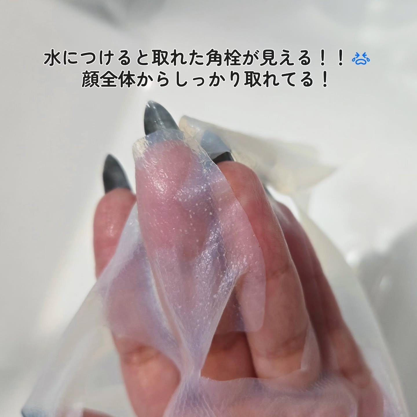 トラブルパッチマスク/EIOM/その他スキンケアを使ったクチコミ（3枚目）