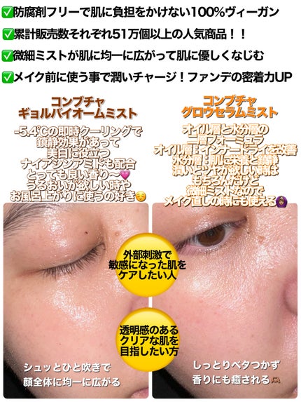 コンブチャ ギョルバイオムミスト/Elishacoy/ミスト状化粧水を使ったクチコミ(3枚目)