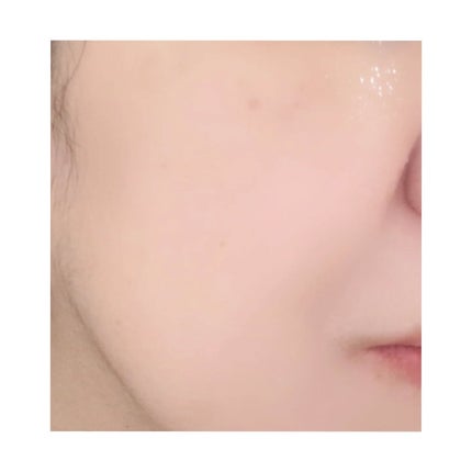 トラブルパッチマスク/EIOM/その他スキンケアを使ったクチコミ(5枚目)