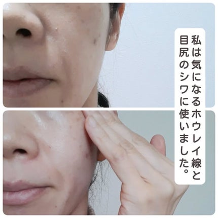 プラセホワイター 薬用美白アイクリーム/明色/アイケア・アイクリームを使ったクチコミ(5枚目)