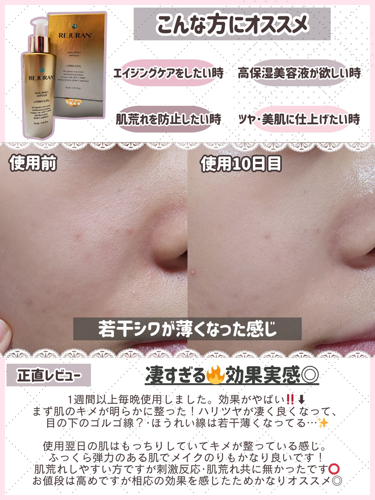 REJURAN デュアル エフェクト アンプル 30mL/REJURAN COSMETICS/美容液を使ったクチコミ（3枚目）