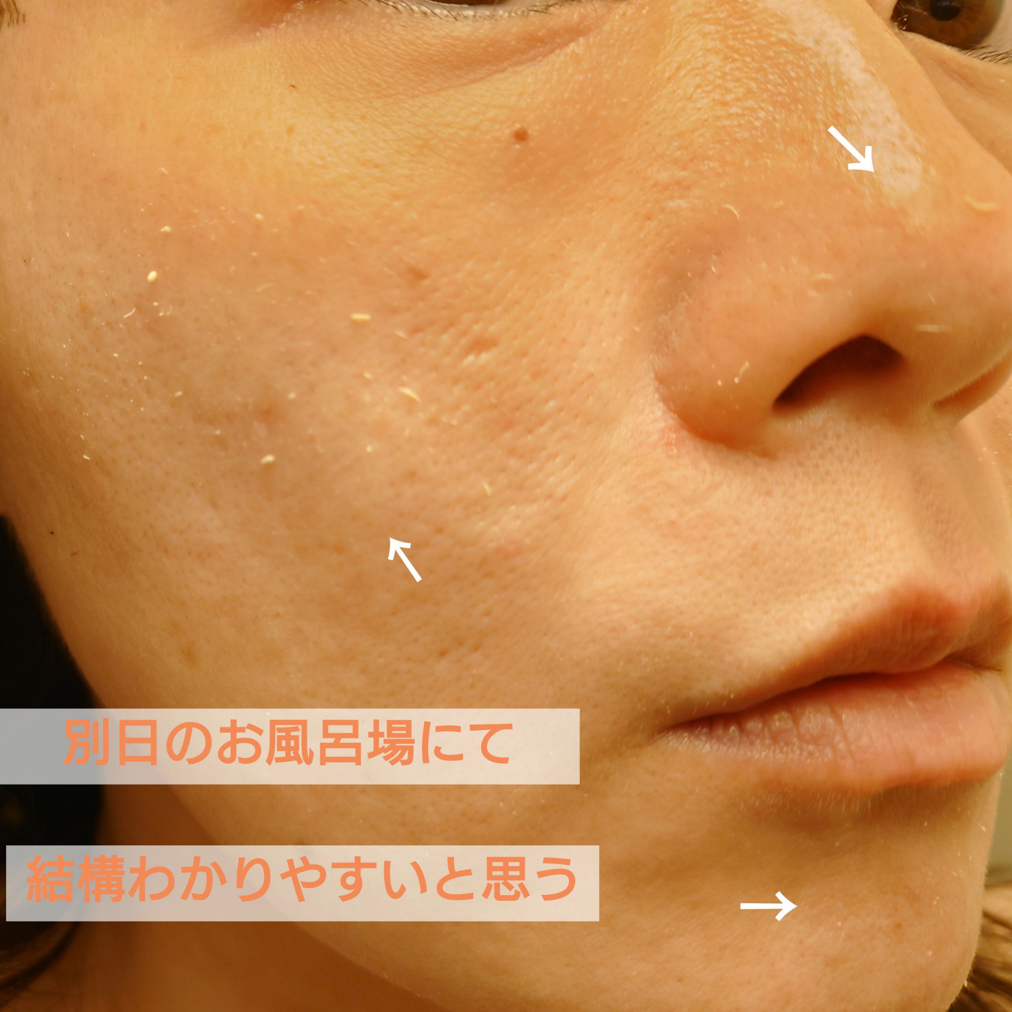 RXアドバンスド ザ・ビタミンC23セラム/COSRX/美容液を使ったクチコミ（3枚目）