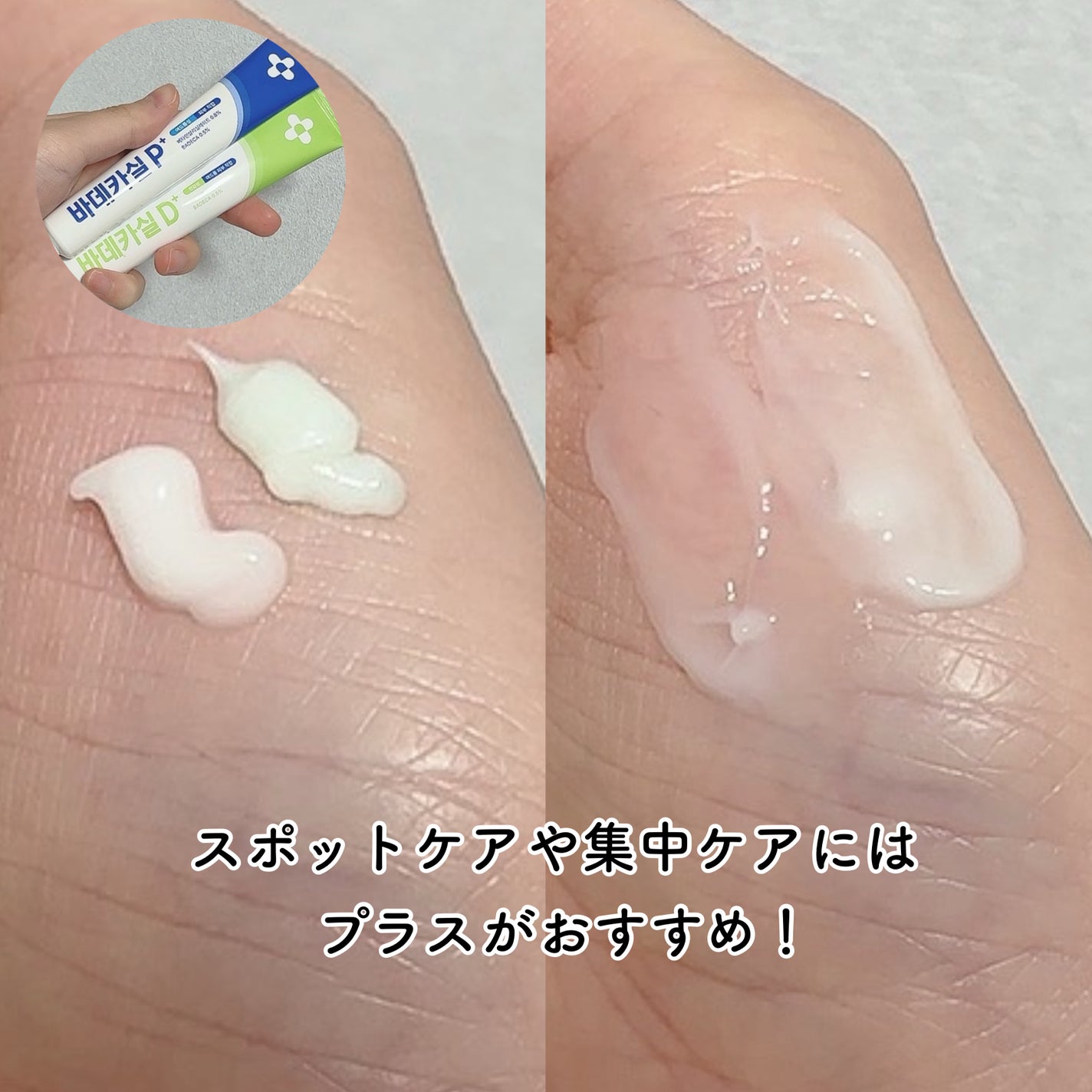 バデカシルDクリーム/23years old/フェイスクリームを使ったクチコミ(6枚目)