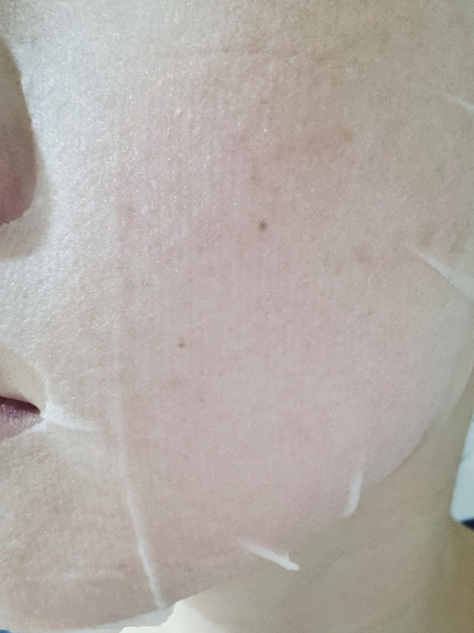 復活草シートマスクデイリーピック/Abib /シートマスク・パックを使ったクチコミ（3枚目）