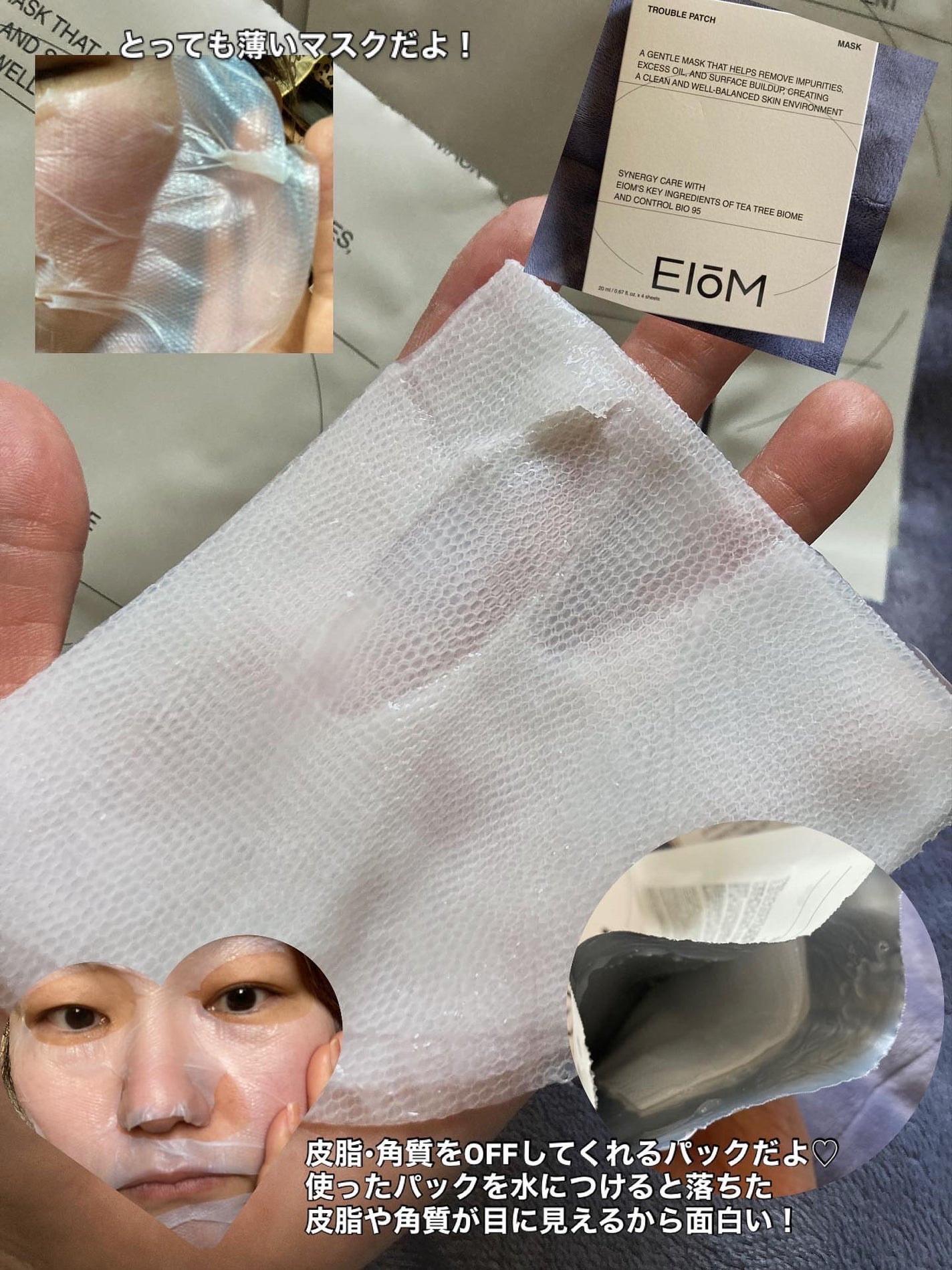 トラブルパッチマスク/EIOM/その他スキンケアを使ったクチコミ(2枚目)