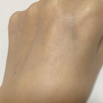 ブレミッシュケアアップ セラム/ISOI/美容液を使ったクチコミ(5枚目)