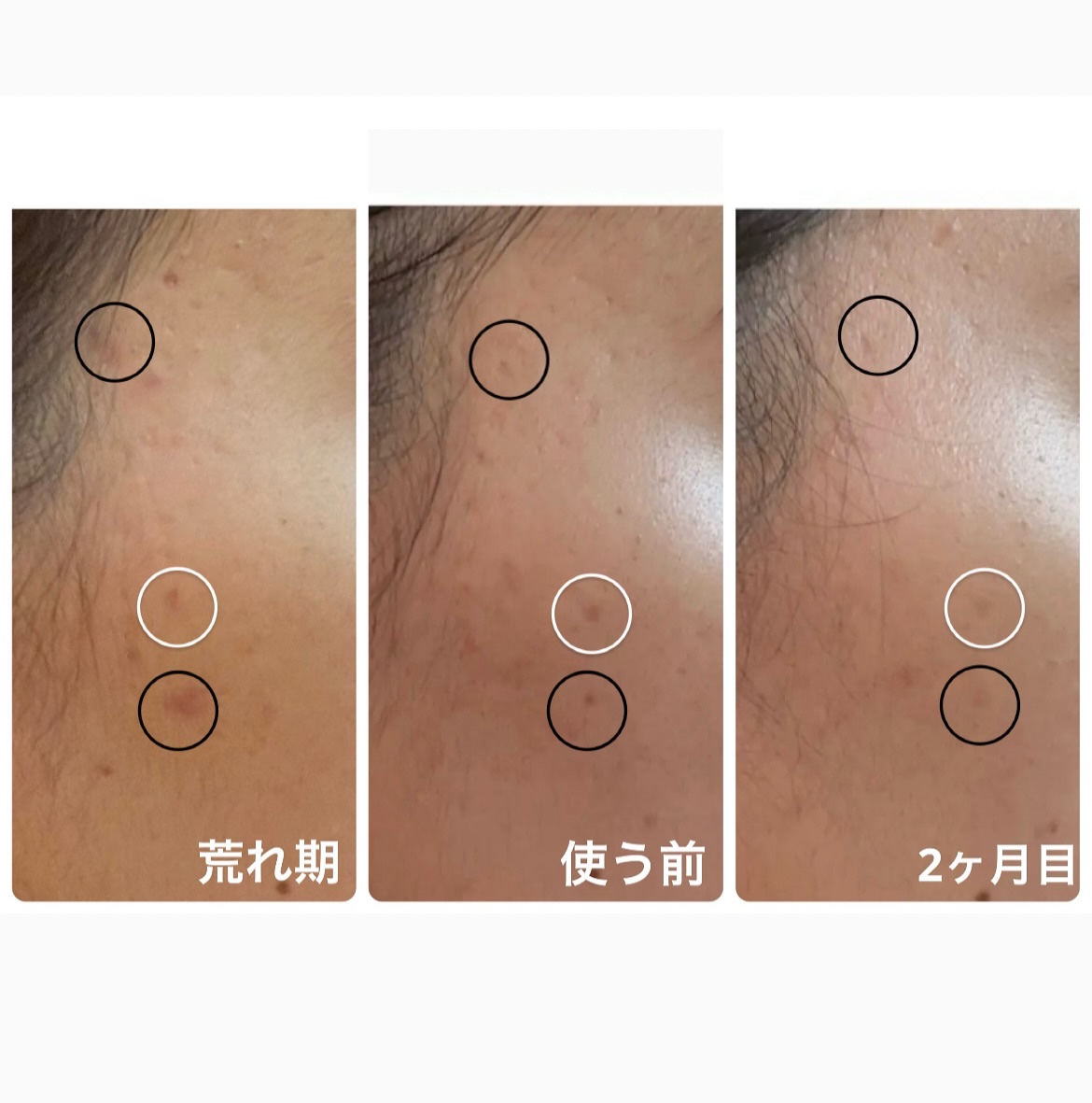 AGE-R ブースタープロ/MEDICUBE/美顔器・マッサージを使ったクチコミ（2枚目）