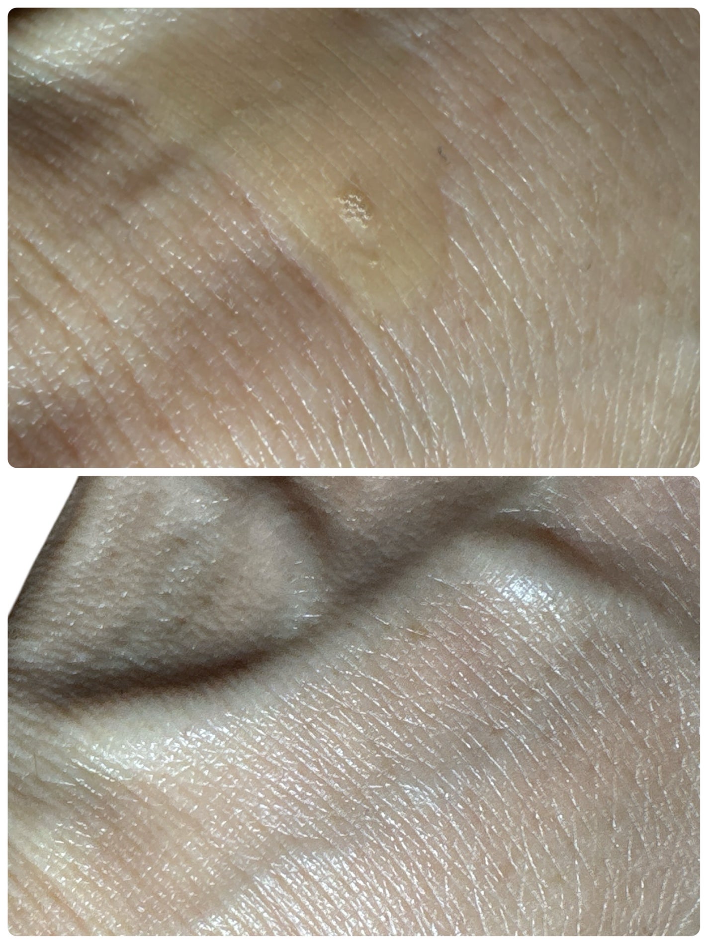 RXザ・ビタミンC23セラム/COSRX/美容液を使ったクチコミ(6枚目)