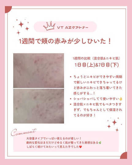 AZケア トナー/VT/化粧水を使ったクチコミ(2枚目)