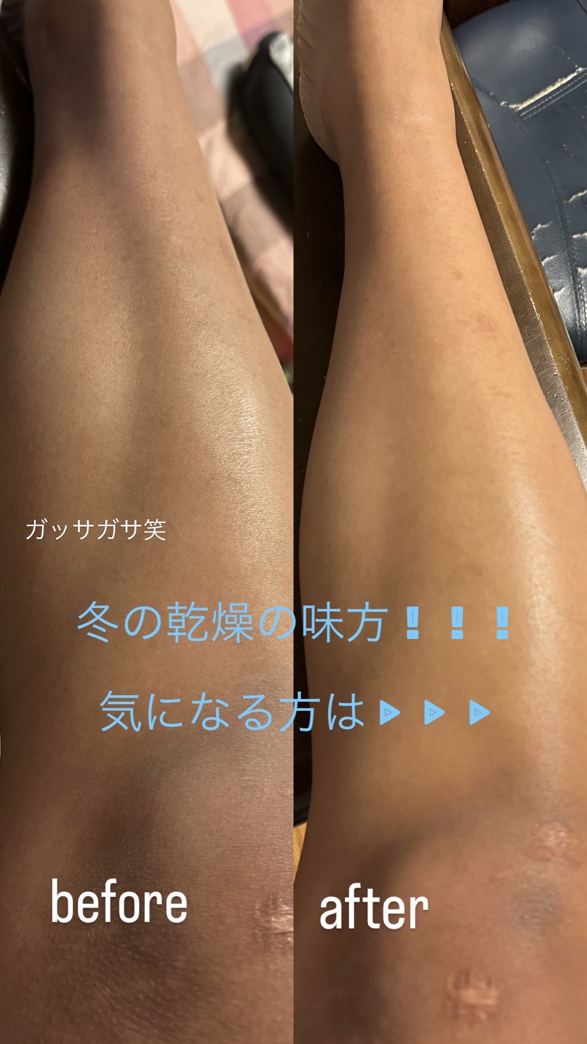 ★Neutrogenaノルウェー フォーミュラ インテンスリペア ボディ エマルジョン★


税込¥1,236円でたっぷり入っててのびも良いからほんとにコスパ良いし、がスっガスになった私のふくらはぎとか膝も一気に潤って、正座した時にあ！乾燥