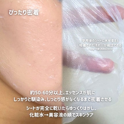 トラブルパッチマスク/EIOM/その他スキンケアを使ったクチコミ(4枚目)