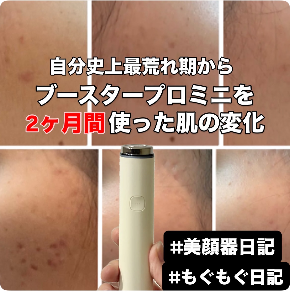 AGE-R ブースタープロ/MEDICUBE/美顔器・マッサージを使ったクチコミ（1枚目）