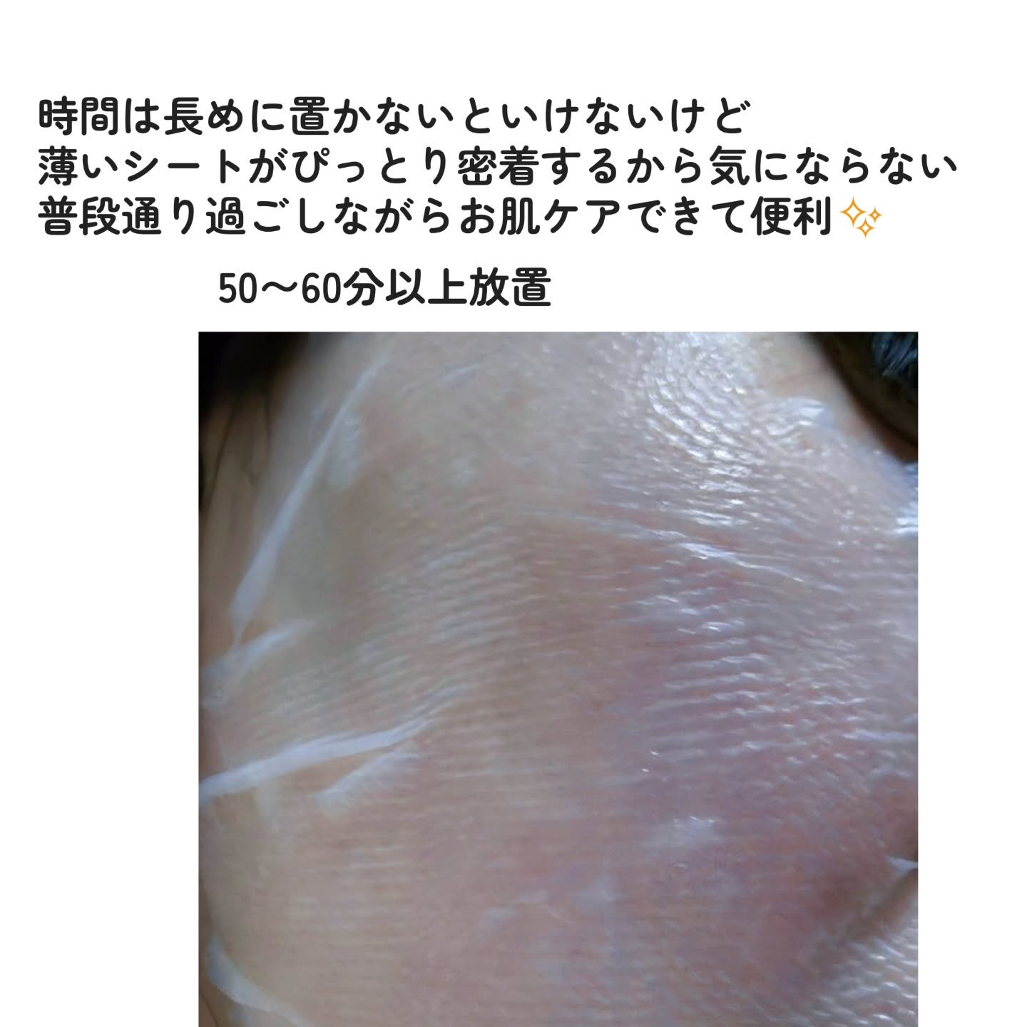 トラブルパッチマスク/EIOM/その他スキンケアを使ったクチコミ（2枚目）