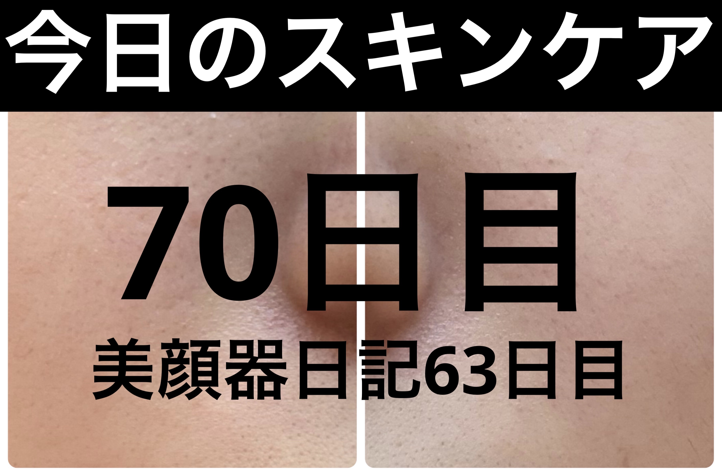 AZケア マスク/VT/シートマスク・パックを使ったクチコミ（1枚目）