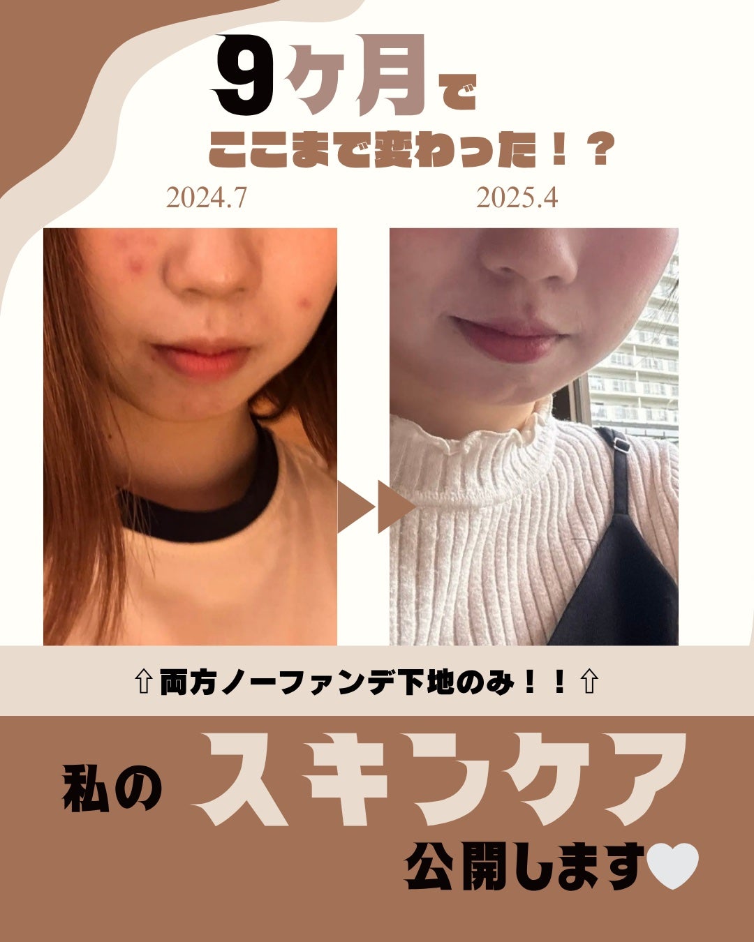 資生堂ベビーパウダー(プレスド)/ベビー/ボディパウダーを使ったクチコミ(1枚目)