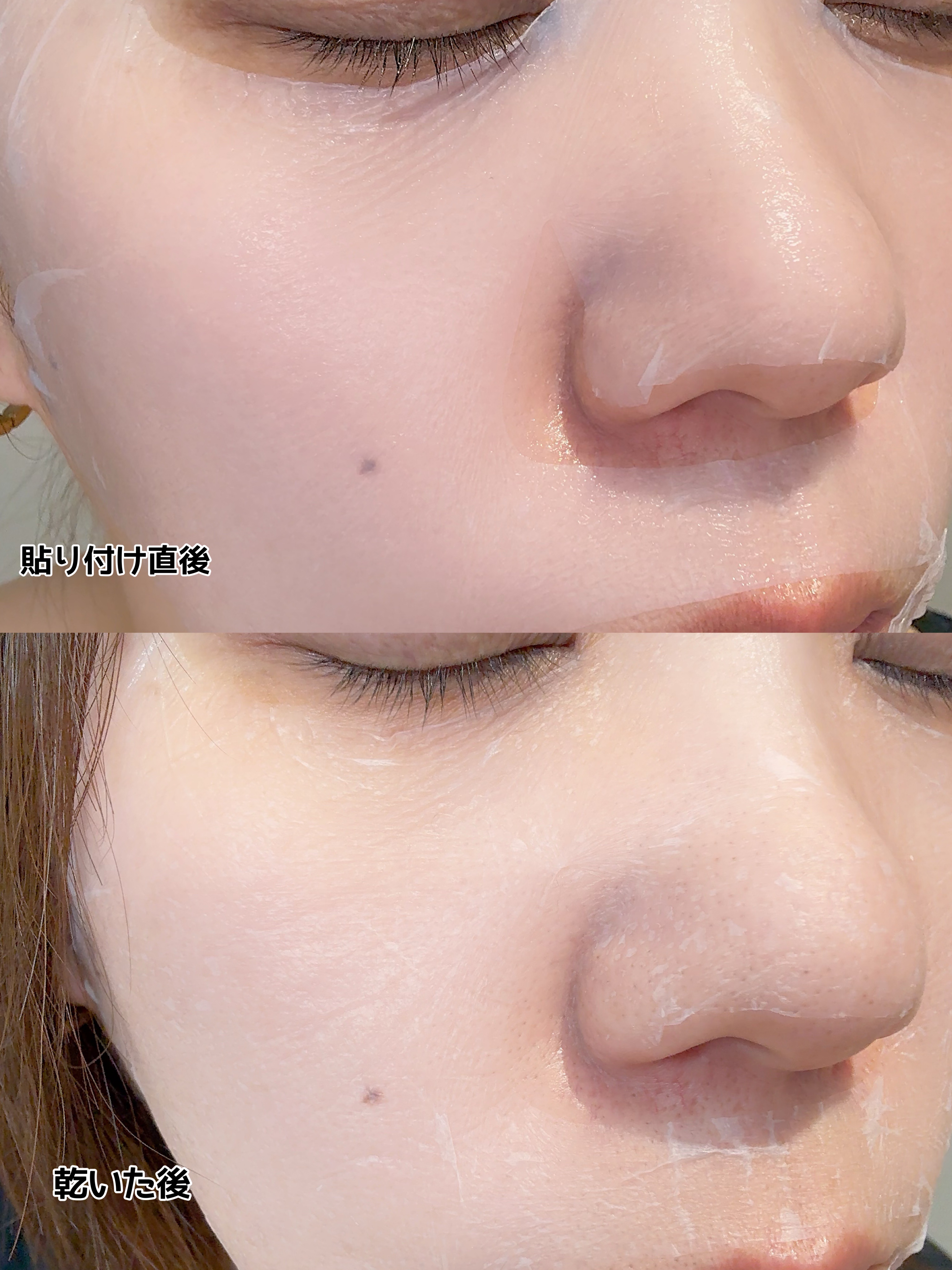 トラブルパッチマスク/EIOM/その他スキンケアを使ったクチコミ（3枚目）