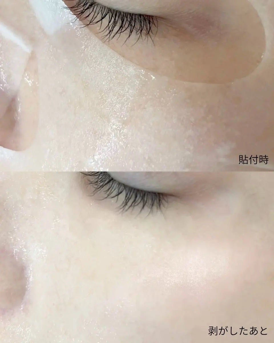 ローゼPDRNエッセンシャルマスクヘルシーグロウ/MEDIHEAL/シートマスク・パックを使ったクチコミ(4枚目)