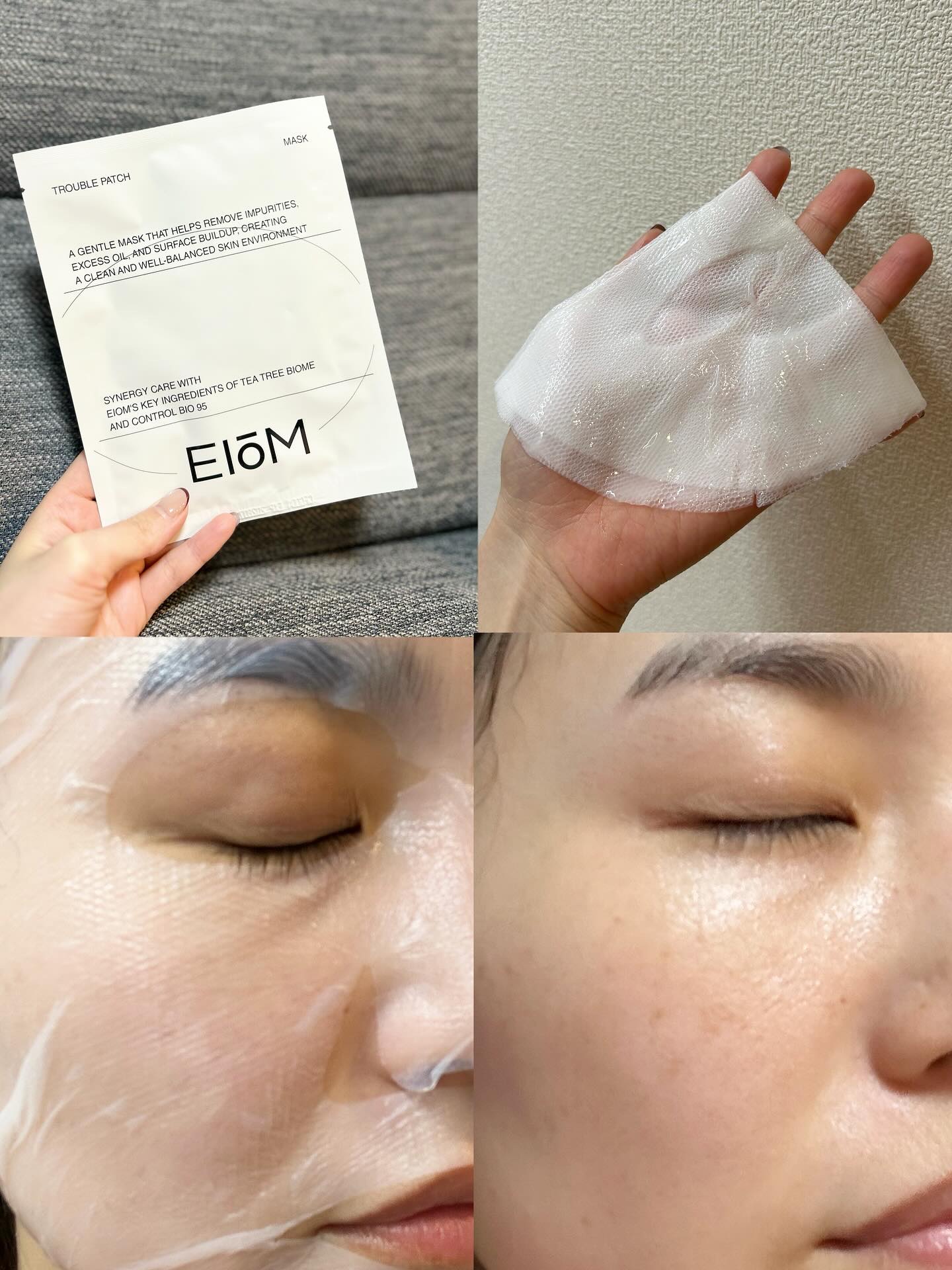 トラブルパッチマスク/EIOM/その他スキンケアを使ったクチコミ（2枚目）
