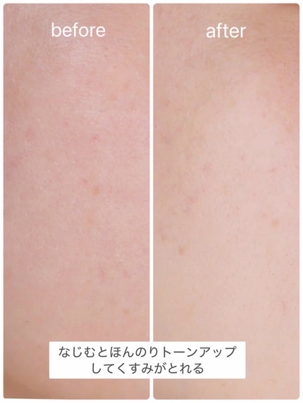 ポアタイトニングアンプル /REJURAN COSMETICS/美容液を使ったクチコミ(4枚目)