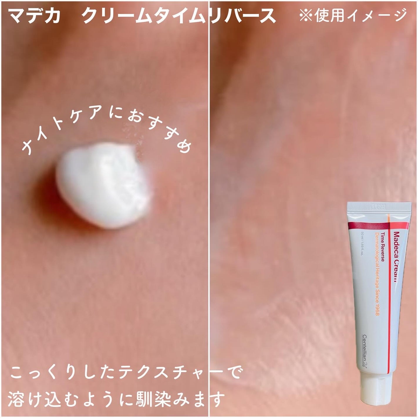 マデカクリームタイムリバース/センテリアン24/フェイスクリームを使ったクチコミ(4枚目)