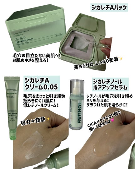 シカレチA クリーム0.05/VT/フェイスクリームを使ったクチコミ(3枚目)