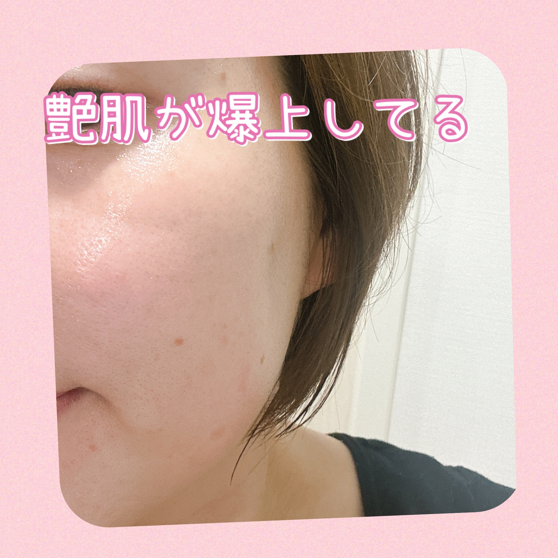 ウルトラナリシングアドバンスド トナー/HOLITUAL /化粧水を使ったクチコミ（2枚目）