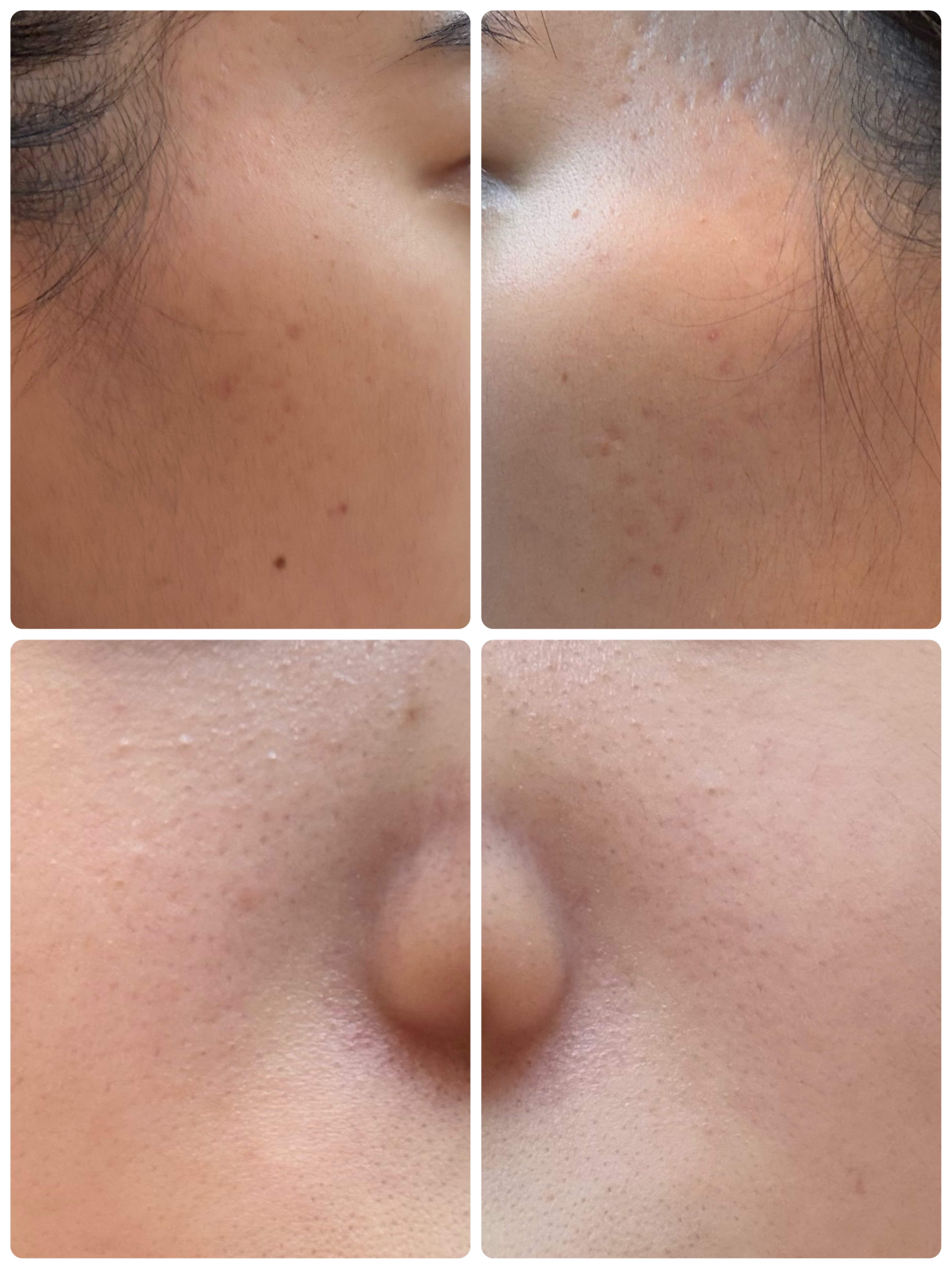 AZケア マスク/VT/シートマスク・パックを使ったクチコミ（2枚目）