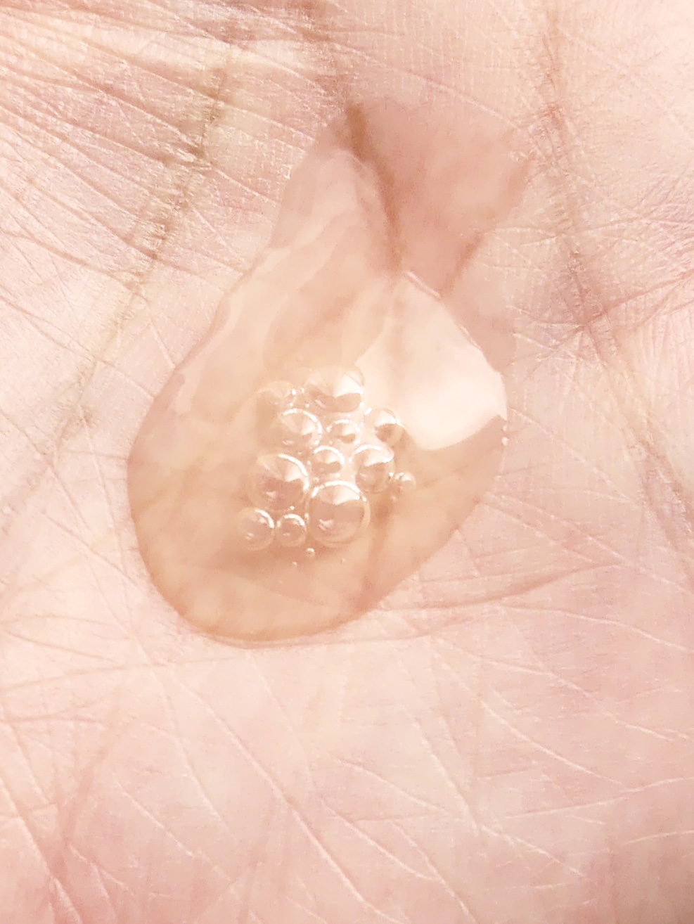 REJURAN ポアタイトニングアンプル 30ml/REJURAN COSMETICS/美容液を使ったクチコミ（2枚目）