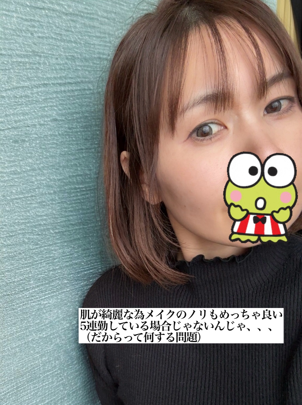 トラブルパッチマスク/EIOM/その他スキンケアを使ったクチコミ（3枚目）