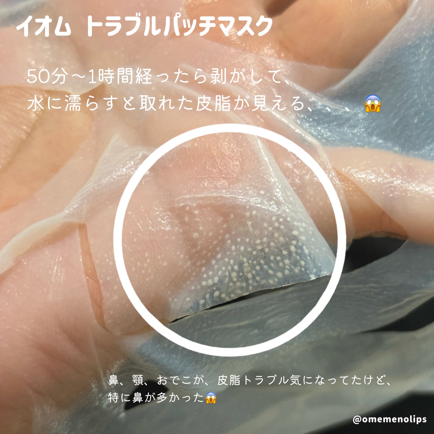 トラブルパッチマスク/EIOM/その他スキンケアを使ったクチコミ(4枚目)