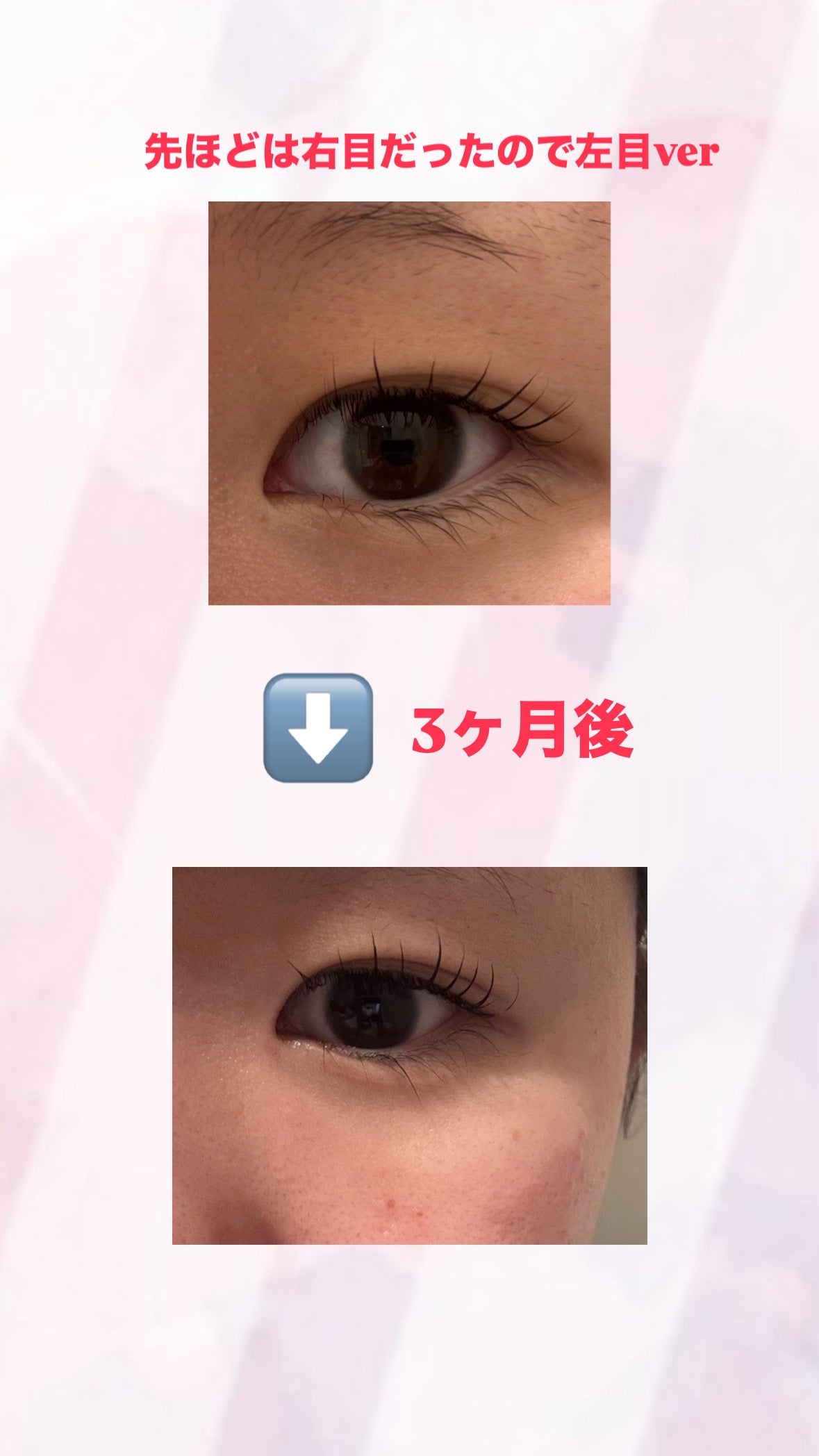 ラッシュアディクト アイラッシュコンディショニングセラム/soaddicted/まつげ美容液を使ったクチコミ(2枚目)