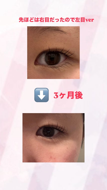 ラッシュアディクト アイラッシュコンディショニングセラム/soaddicted/まつげ美容液を使ったクチコミ(2枚目)