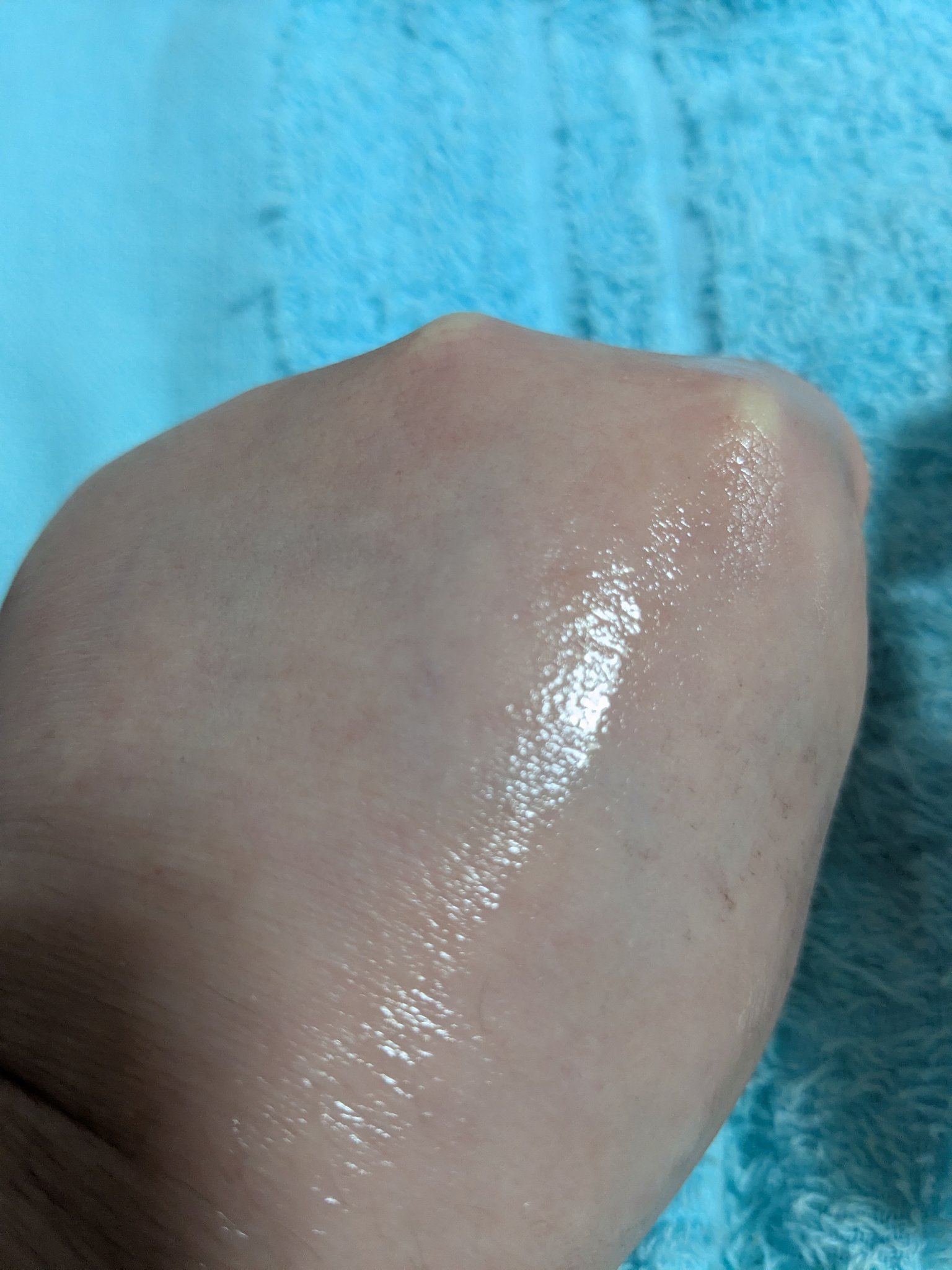 ナインセラム/Dr.Twenty Project/美容液を使ったクチコミ（3枚目）