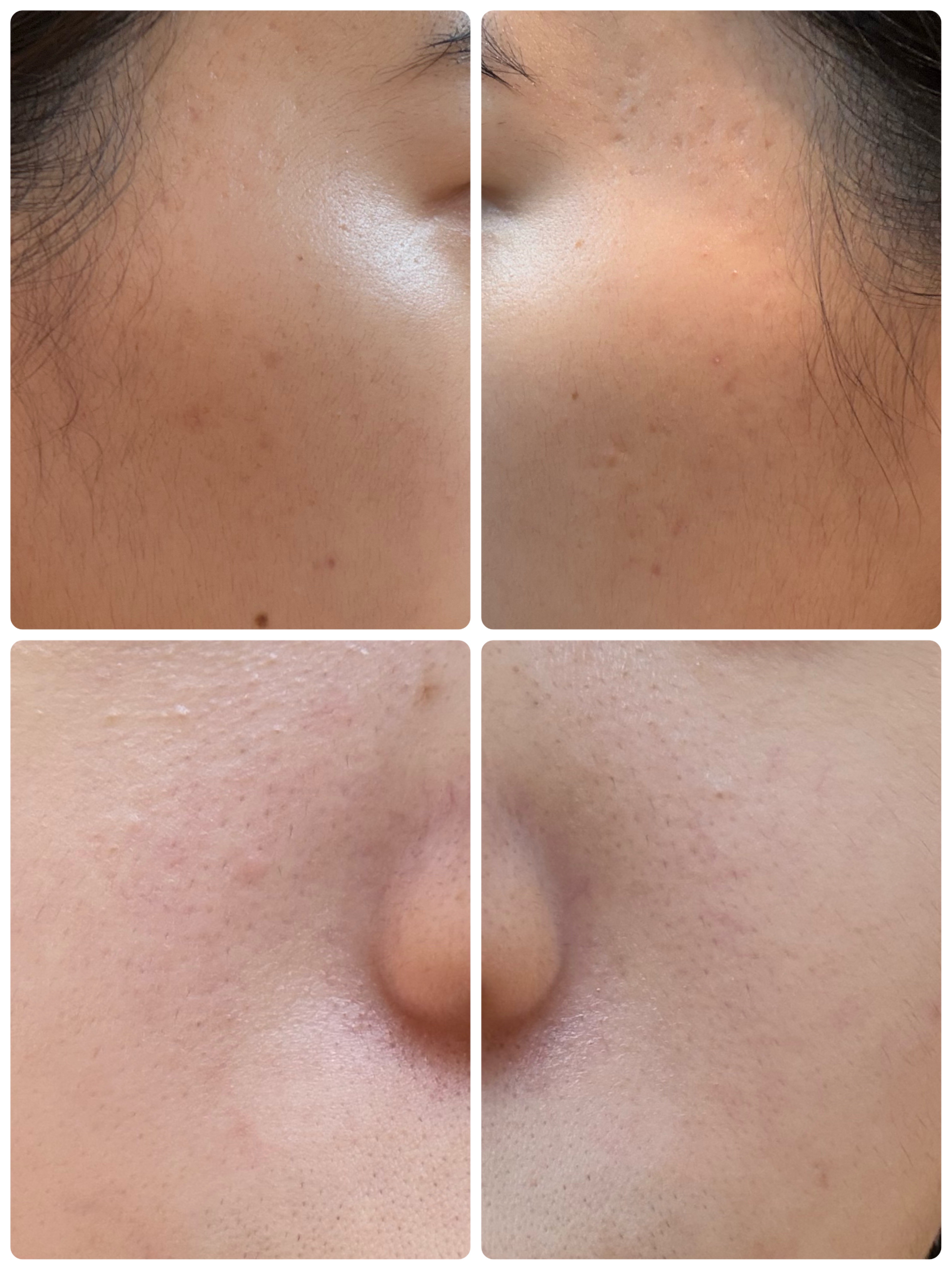 グルタチオングロウ クレンジングオイル/VT/オイルクレンジングを使ったクチコミ（2枚目）