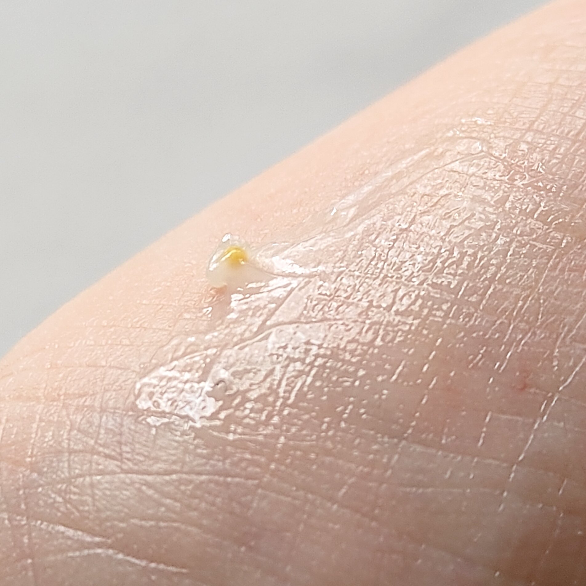 ナイトニードルリップ　ディープモイスト/CHOOSY/リップ美容液を使ったクチコミ（2枚目）