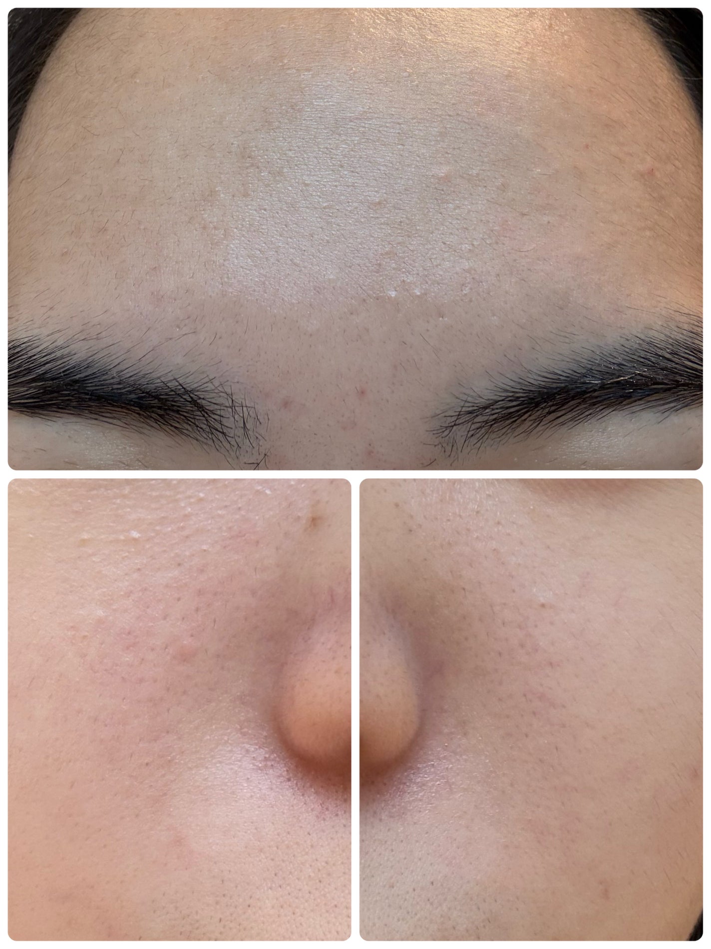 モーニングジェルウォッシュ/ビトレスキン/その他洗顔料を使ったクチコミ(3枚目)