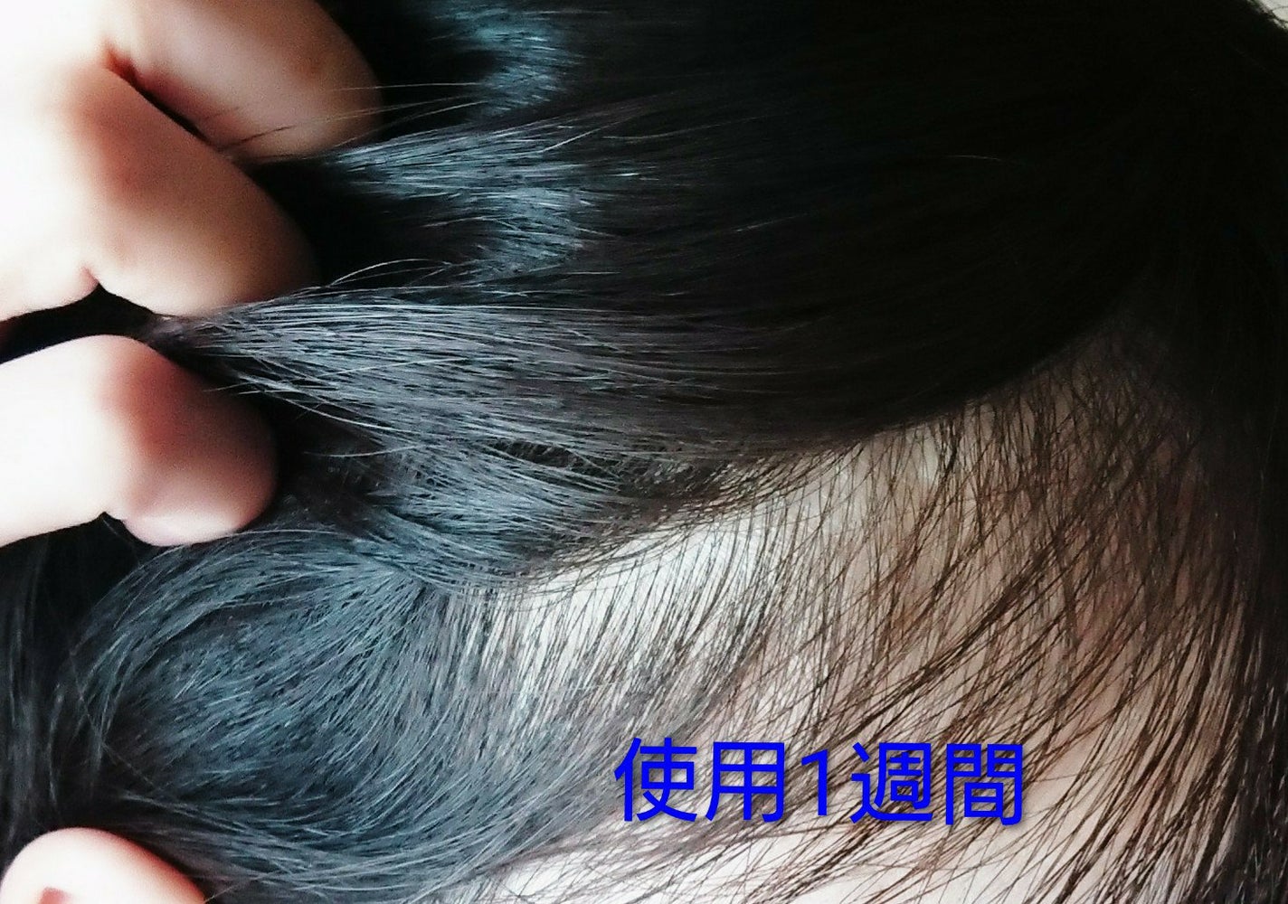 アデノバイタル スカルプ パワーショット/サブリミック/頭皮ローションを使ったクチコミ(6枚目)