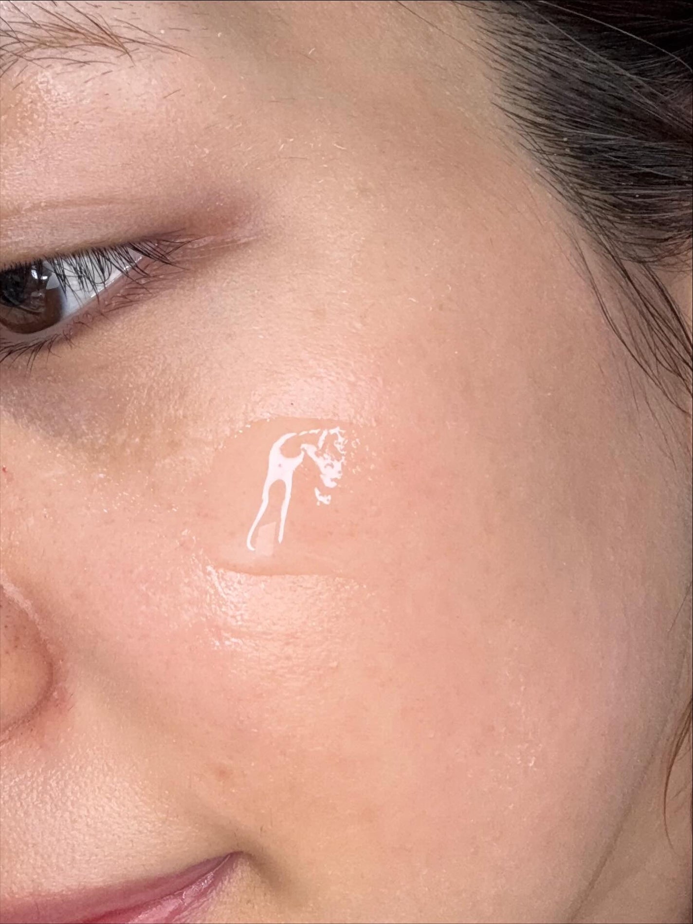 ブレミッシュケアアップ セラム/ISOI/美容液を使ったクチコミ(3枚目)