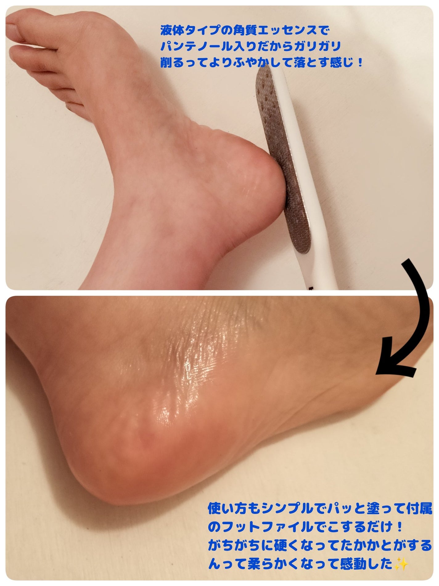 ゆきな on LIPS 「Baren様から提供いただきましたbaren足角質消しホームセ..」(2枚目)