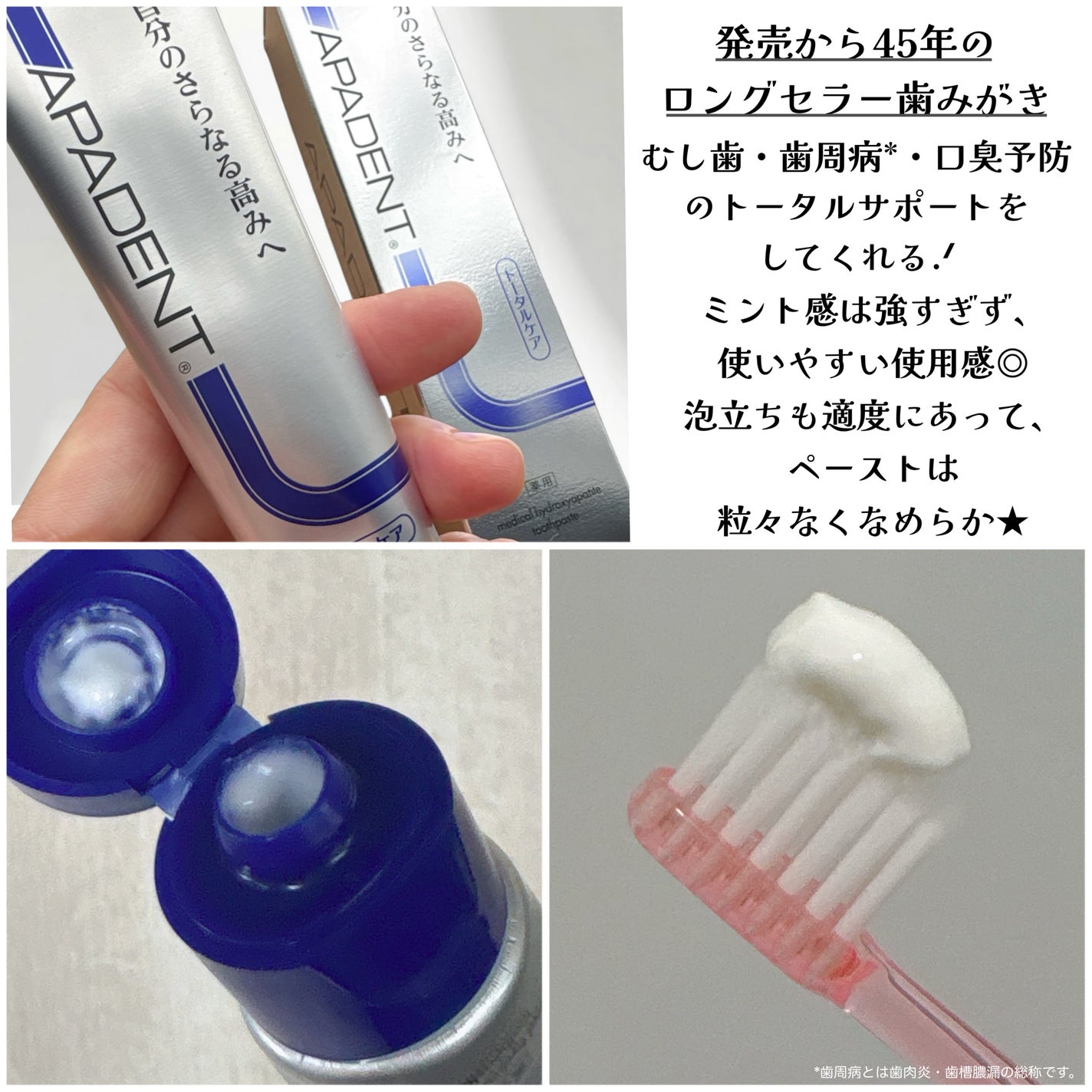 アパデント トータルケア/アパデント/歯磨き粉を使ったクチコミ(2枚目)