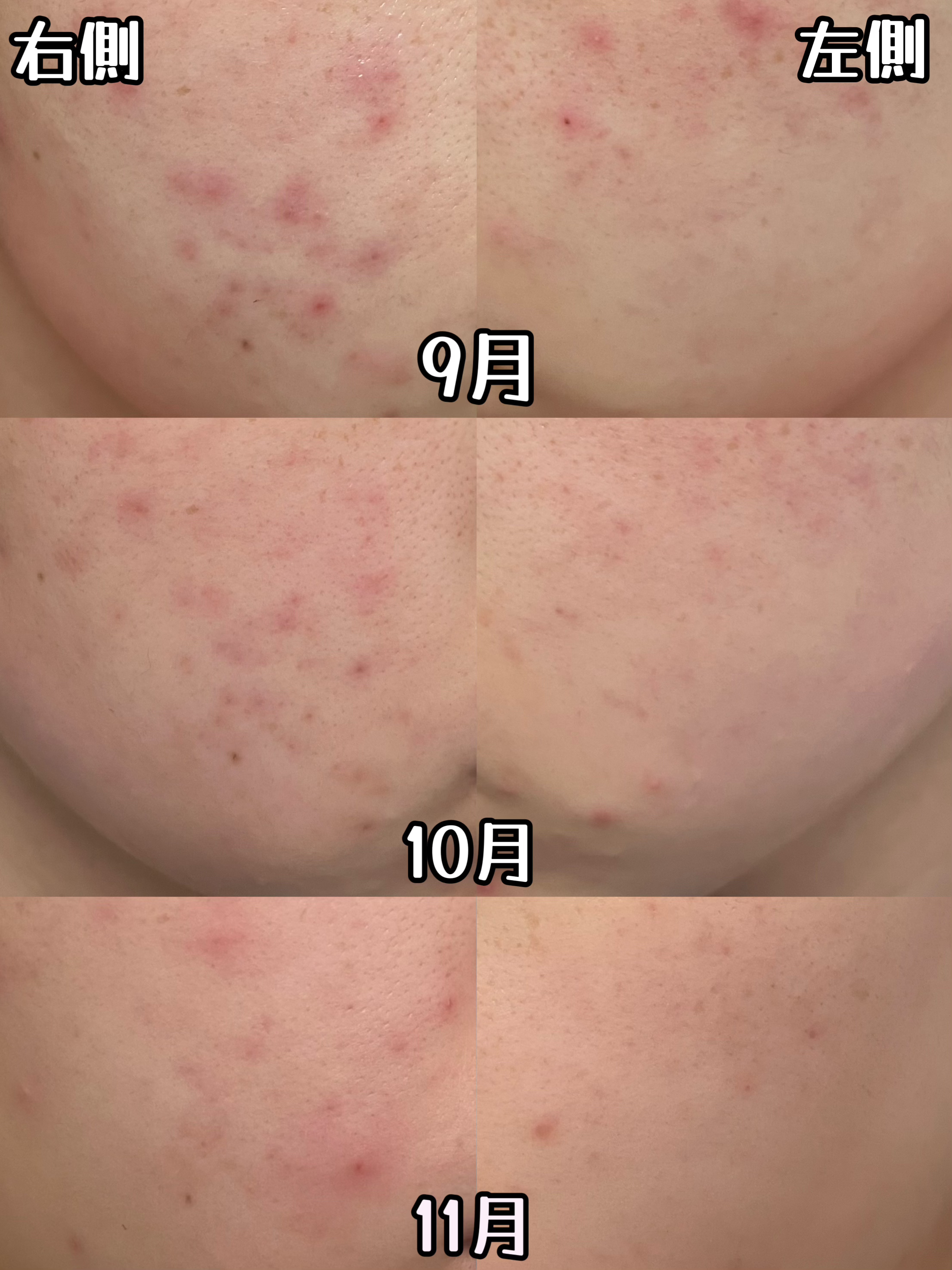 ベリーお元気？/ラッシュ/洗い流すパック・マスクを使ったクチコミ（2枚目）