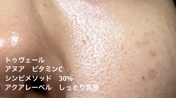 AN on LIPS 「洗顔後、ケア後載せましたがあんまり変化してなく見えます。メガネ..」(4枚目)