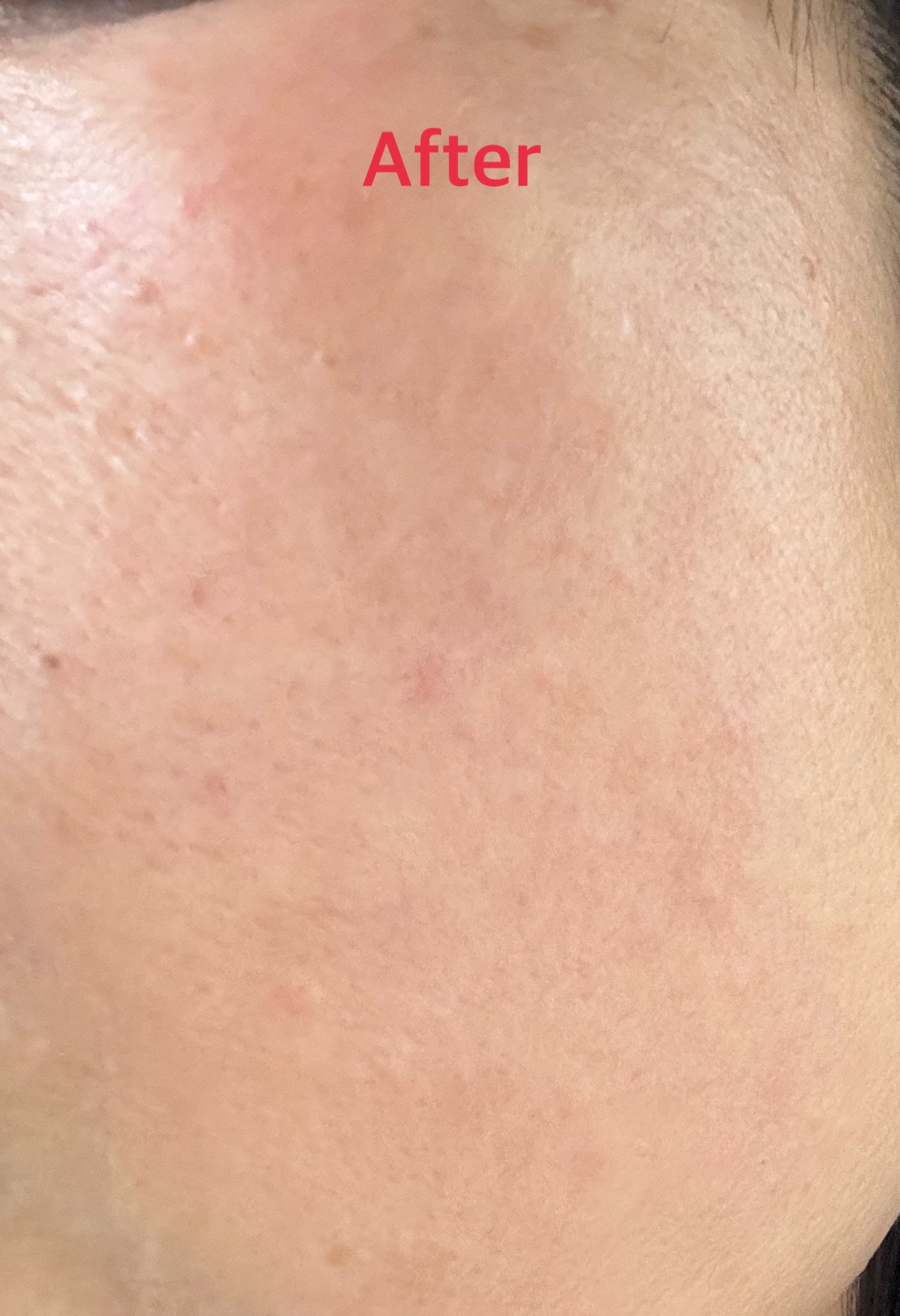 フローリフティングラッピングクリーム/koy/フェイスクリームを使ったクチコミ(4枚目)