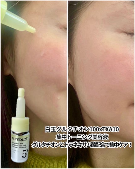 5番 白玉グルタチオン100×TXA10集中トーニング美容液/numbuzin/美容液を使ったクチコミ(3枚目)