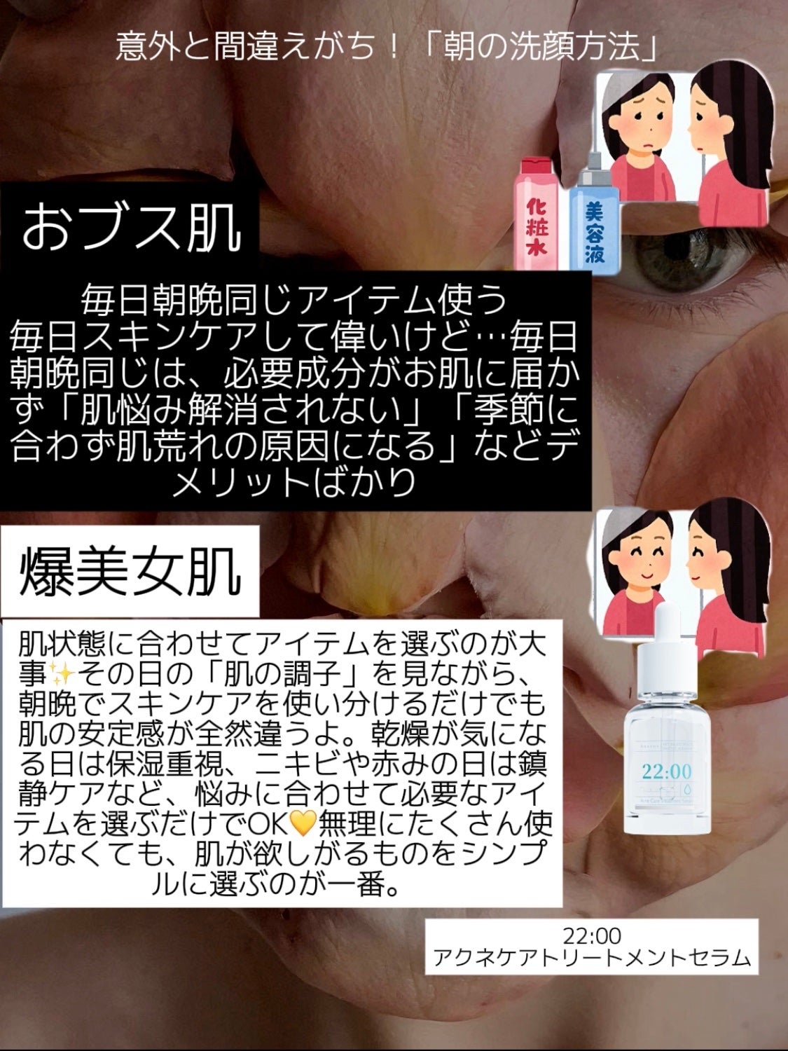 アネトス アクネケア トリートメント セラム/Anetos/美容液を使ったクチコミ(4枚目)