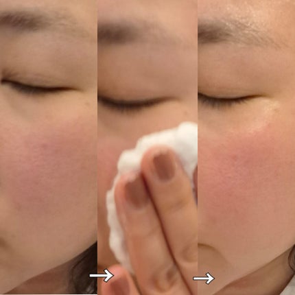 エアバブルCDSマスク/GASH/洗い流すパック・マスクを使ったクチコミ(4枚目)