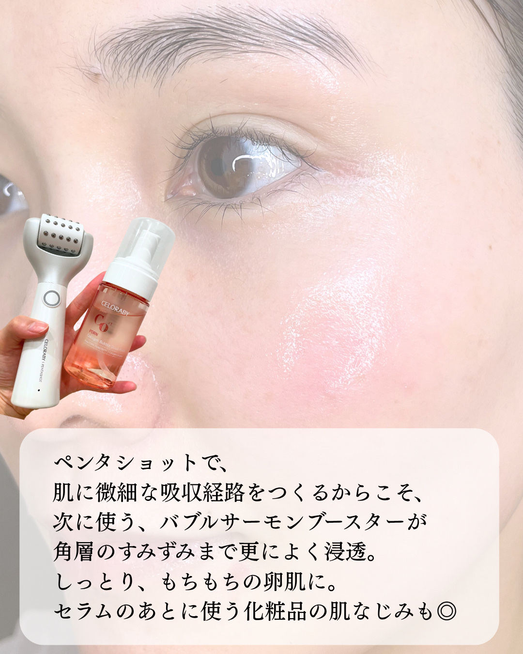 ペンタショット　美顔器 ペンタショット｜CELORABYの効果に関する口コミ - #PR 【CELORABY