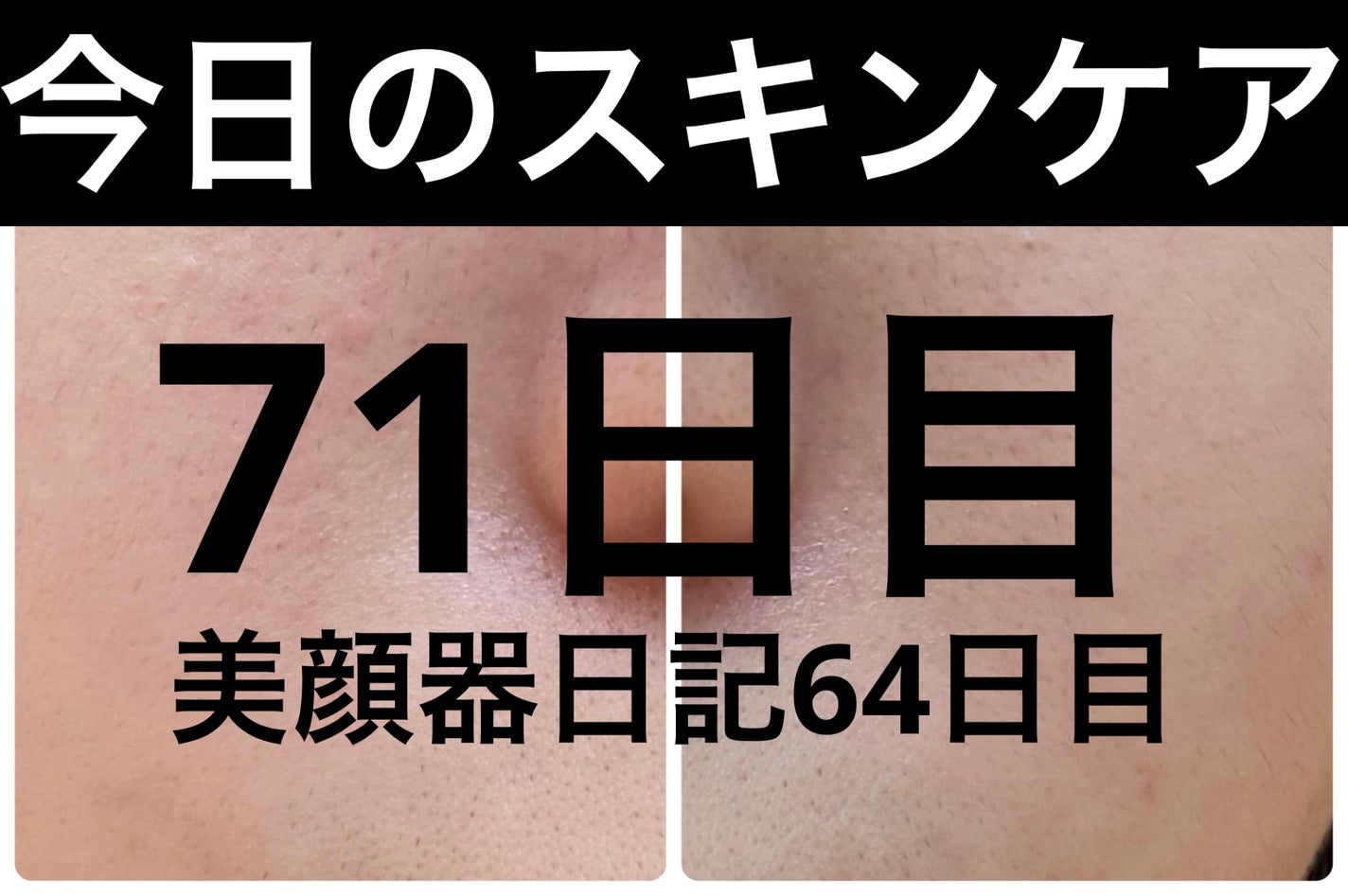 モーニングジェルウォッシュ/ビトレスキン/その他洗顔料を使ったクチコミ(1枚目)